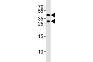 SIRT3 antibody western blot analysis in 293 cell lysate. (SIRT3 Antikörper  (AA 250-279))