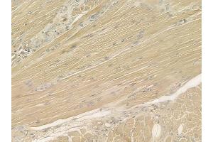 ABIN6260665 and ABIN6277012 at 1/100 staining human tongue carcinoma by IHC-P.