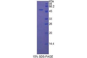 SDS-PAGE (SDS) image for Left-Right Determination Factor 1 (LEFTY1) (AA 169-368) protein (His tag,GST tag) (ABIN2123156) (LEFTY1 Protein (AA 169-368) (His tag,GST tag))