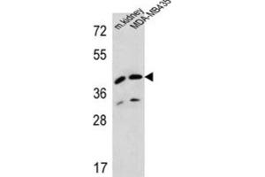 Western Blotting (WB) image for anti-L-2-Hydroxyglutarate Dehydrogenase (L2HGDH) antibody (ABIN2995585)