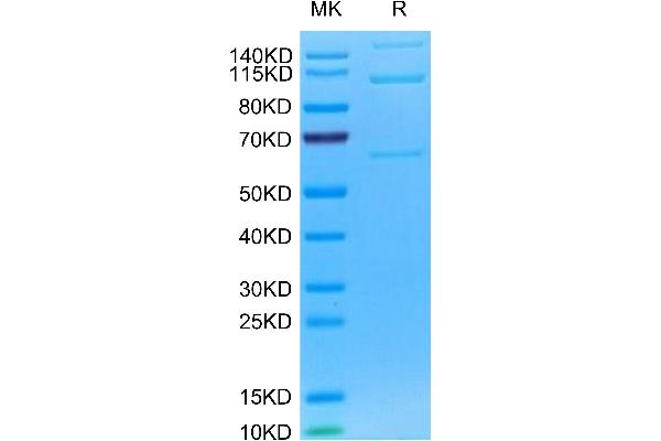 C3 Protein (AA 25-1663) (His tag)