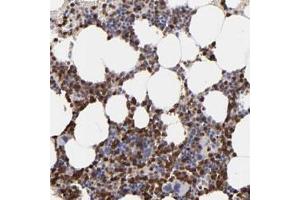 Immunohistochemical staining of human bone marrow with NCF2 polyclonal antibody  shows strong cytoplasmic positivity in bone marrow poietic cells. (NCF2 Antikörper)