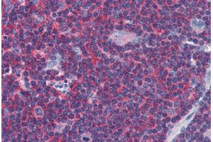 Human Tonsil: Formalin-Fixed, Paraffin-Embedded (FFPE) (Arrestin 3 Antikörper  (AA 300-410))