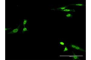 Immunofluorescence (IF) image for anti-Creatine Kinase, Muscle (CKM) (AA 1-381) antibody (ABIN514428)