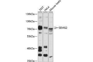 Western blot analysis of extracts of various cell lines, using SEMG2 antibody (ABIN6128756, ABIN6147529, ABIN6147531 and ABIN6216592) at 1:3000 dilution. (SEMG2 Antikörper  (AA 383-582))