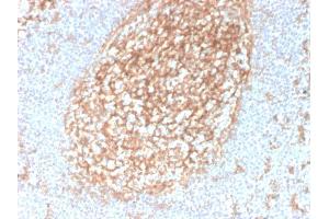 Immunohistochemistry (IHC) image for anti-CD14 (CD14) (AA 25-148) antibody (ABIN6941093)