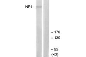 Western blot analysis of extracts from HepG2 cells, using NF1 Antibody.