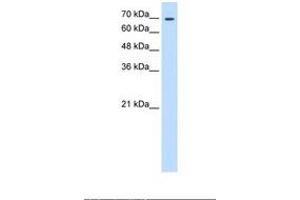 Image no. 1 for anti-Transglutaminase 2 (C Polypeptide, Protein-Glutamine-gamma-Glutamyltransferase) (TGM2) (N-Term) antibody (ABIN6738366) (Transglutaminase 2 Antikörper  (N-Term))