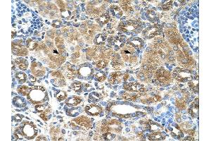 UBXD2 antibody was used for immunohistochemistry at a concentration of 4-8 ug/ml.