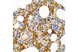 Immunohistochemistry of paraffin-embedded rat lung using TFF1 antibody (ABIN5970904) at dilution of 1/200 (40x lens).