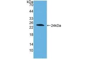 Detection of Recombinant DISC1, Human using Polyclonal Antibody to Disrupted In Schizophrenia 1 (DISC1) (DISC1 Antikörper  (AA 102-261))