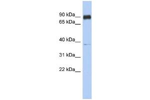 WB Suggested Anti-CCDC157 Antibody Titration: 0. (CCDC157 Antikörper  (Middle Region))