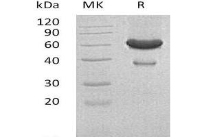 Western Blotting (WB) image for Ephrin A1 (EFNA1) (Active) protein (His tag,Fc Tag) (ABIN7320512)