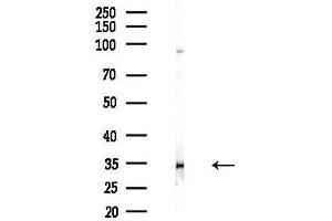 Western blot analysis of lysates from HepG2 cells(LPS,4h treatment), using ELOVL1 Antibody at 1/1000 dilution.
