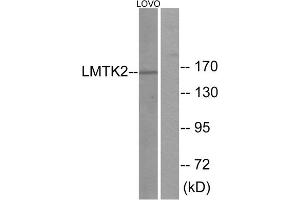 Western blot analysis of extracts from LOVO cells, using LMTK2 antibody. (LMTK2 Antikörper  (Internal Region))