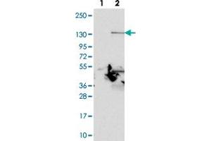 Western blot analysis of Lane 1: Negative control (vector only transfected HEK293T lysate).