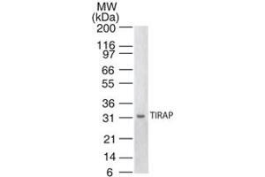 Western blot analysis of TIRAP. (TIRAP Antikörper)