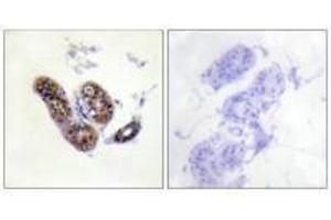 Immunohistochemistry analysis of paraffin-embedded human skin tissue using MITF (Ab-180/73) antibody. (MITF Antikörper  (Ser73, Ser180))