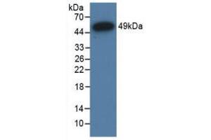 Western Blot; Sample: Recombinant NR3C1, Human. (Glucocorticoid Receptor Antikörper  (AA 598-755))