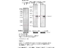 Sample Type: 1. (RAB9A Antikörper  (Middle Region))