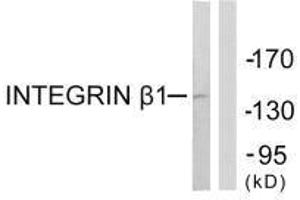 Western blot analysis of extracts from Jurkat cells, using Integrin β1 (Ab-789) antibody. (ITGB1 Antikörper  (Thr789))