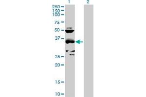 Western Blot analysis of CCBL1 expression in transfected 293T cell line by CCBL1 MaxPab polyclonal antibody. (CCBL1 Antikörper  (AA 1-374))