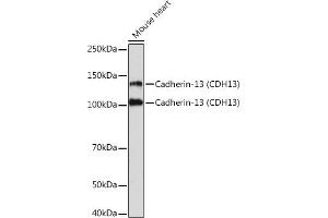 Western blot analysis of extracts of Mouse heart, using Cadherin-13 (CDH13) Rabbit mAb (ABIN7265996) at 1:1000 dilution. (Cadherin 13 Antikörper)