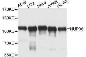 Western blot analysis of extracts of various cell lines, using NUP98 antibody (ABIN5970195) at 1/1000 dilution. (NUP98 Antikörper)