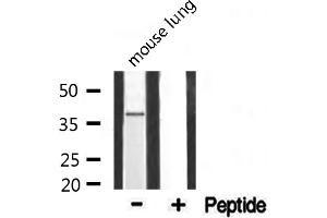Western blot analysis of extracts from mouse lung, using 5-HT-1F antibody.
