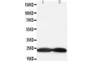 Anti-BAK antibody, Western blotting All lanes: Anti BAK  at 0. (BAK1 Antikörper  (Middle Region))