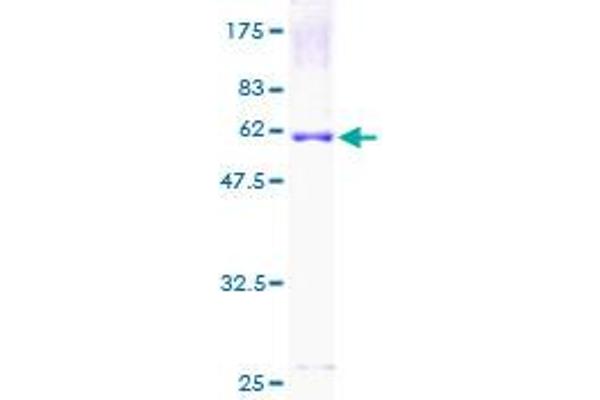 UCP2 Protein (AA 1-309) (GST tag)