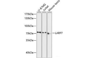 Western blot analysis of extracts of various cell lines using LARP7 Polyclonal Antibody at dilution of 1:3000. (LARP7 Antikörper)