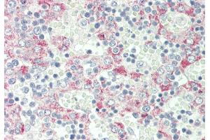 Immunohistochemistry (IHC) image for anti-C-Type Lectin Domain Family 1, Member B (CLEC1B) (N-Term) antibody (ABIN2782892)