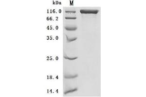 Selectin P (Granule Membrane Protein 140kDa, Antigen CD62) (SELP) (AA 42-771) (Active) protein (His tag)