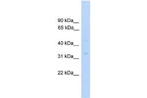 WB Suggested Anti-MTFMT Antibody Titration:  0. (MTFMT Antikörper  (C-Term))