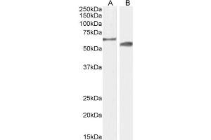 ABIN6391375 (2µg/ml) staining of Mouse (A) and Rat (B) Testes lysate (35µg protein in RIPA buffer). (CYP2R1 Antikörper  (AA 405-418))