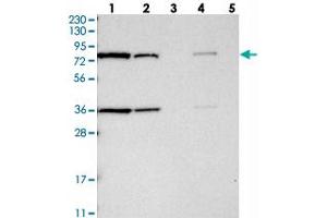 Western blot analysis of Lane 1: RT-4, Lane 2: U-251 MG, Lane 3: Human Plasma, Lane 4: Liver, Lane 5: Tonsil with HSD17B4 polyclonal antibody  at 1:250-1:500 dilution.