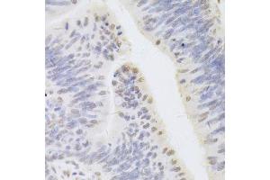 Immunohistochemistry (Paraffin-embedded Sections) (IHC (p)) image for anti-Hepatoma-Derived Growth Factor (HDGF) (AA 1-240) antibody (ABIN6141694)