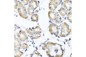 Immunohistochemistry of paraffin-embedded human stomach using RBP2 antibody (ABIN5974059) at dilution of 1/100 (40x lens). (RBP2 Antikörper)