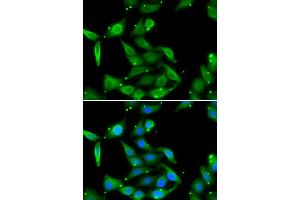 Immunofluorescence analysis of U2OS cells using GAMT antibody (ABIN5973964). (GAMT Antikörper)