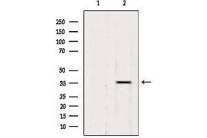 Western blot analysis of extracts from 293, using RALY Antibody. (Raly Antikörper  (Internal Region))