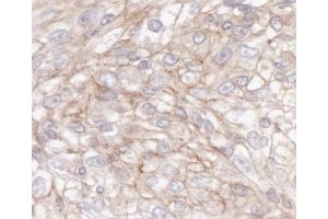 Immunohistochemistry (IHC) image for anti-IQ Motif Containing GTPase Activating Protein 1 (IQGAP1) (AA 1-50) antibody (ABIN7453634) (IQGAP1 Antikörper  (AA 1-50))