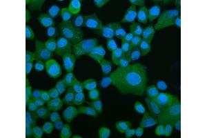 IF analysis of EEF2/Elongation Factor 2 using anti-EEF2/Elongation Factor 2 antibody (ABIN7603142).
