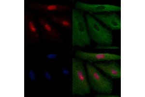 ABIN6258282 and ABIN6275194 staining  cells by IF/ICC.