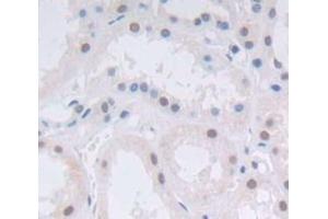 Used in DAB staining on fromalin fixed paraffin- embedded Kidney tissue (Achaete Scute Complex Like Protein 1 (AA 84-236) Antikörper)