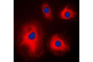 Immunofluorescent analysis of RPS4X staining in A431 cells. (RPS4X Antikörper  (Center))