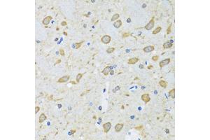 Immunohistochemistry of paraffin-embedded mouse brain using ATG7 antibody. (ATG7 Antikörper)