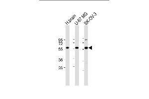 All lanes : Anti-DYNC1LI2 Antibody (Center) at 1:2000 dilution Lane 1: Human brain lysate Lane 2: U-87 MG whole cell lysate Lane 3: SK-OV-3 whole cell lysate Lysates/proteins at 20 μg per lane. (DYNC1LI2 Antikörper  (AA 152-180))