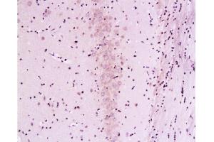 Immunohistochemistry (Paraffin-embedded Sections) (IHC (p)) image for anti-Calcineurin A (CAN) (AA 15-80) antibody (ABIN723890)