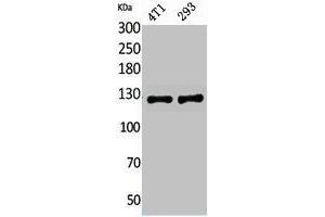 Western Blot analysis of 4T1, 293 cells using Integrin αD Polyclonal Antibody. (ITGAD Antikörper  (Internal Region))